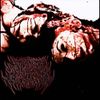 Intercranial Laceration - Intercranial laceration