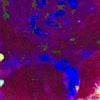 Steriocilia - Avovoid