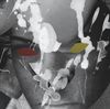 Motorpsycho - Child of the Future