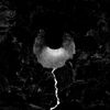 Worn Mantle - Hole