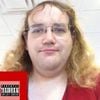 Colon Cancer - Chris Chan