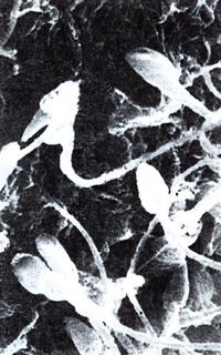 Nurse with Wound - Automating Volume 2