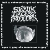 Sebum Excess Production - Hail to Sebaceous Cyst!