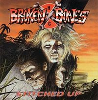Broken Bones - Stitched Up