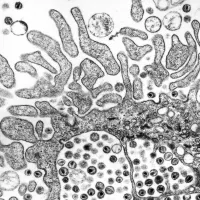 Gonococcus - Sessions #10-15