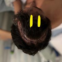 Osmetic - HAPPY DAYS (2025) POST MIX (Post Surgery)