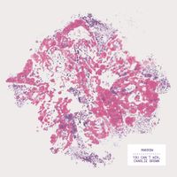 You Can't Win, Charlie Brown - Marrow