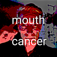 Le11 - Mouth Cancer