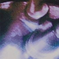 Kyema - 19.00hz - 20.18hz AM&reg; weed
