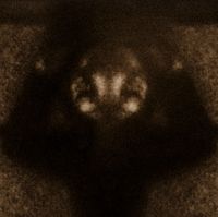 Farsin Khronos - Colostrum of the Carrion Mother