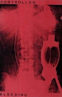 Controlled Bleeding - Controlled Bleeding