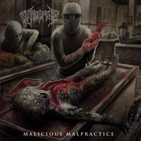 Urosepsis - Malicious Malpractice
