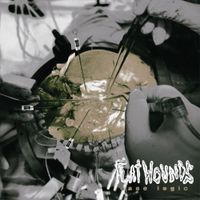 Flatwounds - case logic