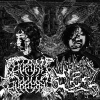 bottom surgery - Split
