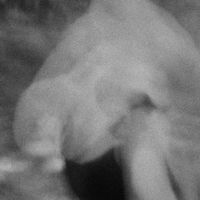 Luci Dead Limb - Humors of the Blood and Skin