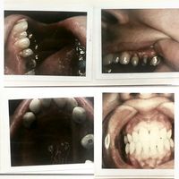 The Kids - Taking Teeth