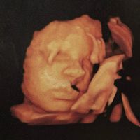 Brucher&ograve; nei pascoli - UMANA