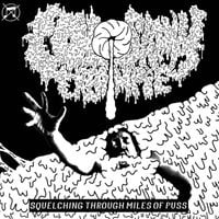 Colostomy Creampie - Squelching Through Miles of Puss