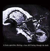Premature Ejaculation - A Little Hard To Swallow