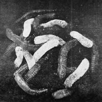 m&ouml;rte - Don't Dig Down&hellip;