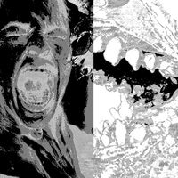 Hank Rube&eacute; - Toothache