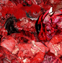 ANALSKULLFUCK - 3 tracks demo