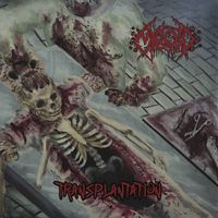 Myeloid - Transplantation