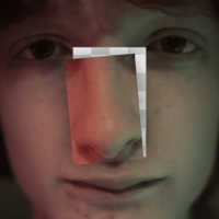 my nose - my nose fell off :(