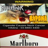 Lipoma - Cigarette Causes Neck Cancer