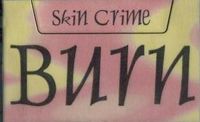 Skin Crime - Burn