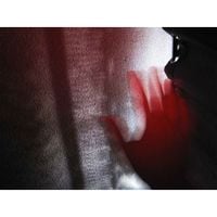 Ilxr - Struggling To Get Back Up // +6