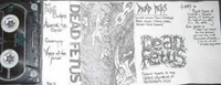 Dead Fetus - Rehersal/Demo 1991