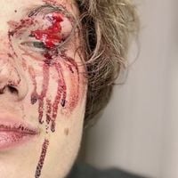 собакой сдохъ - жестокая болезнь мужчин