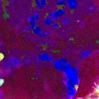 Steriocilia - Avovoid