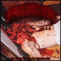 Floccinaucinihilipilification - Self Induced Extracranial Hemorrhaging
