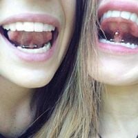 elibanss - Jaw
