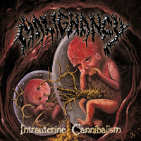 Malignancy - Intrauterine Cannibalism