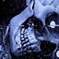 anne october - Bones