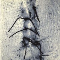 Scheer - Infliction