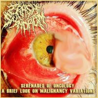 Crash Syndrom - Serenades of Oncology - A Brief Look on Malignancy Variations