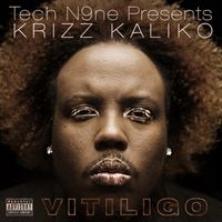 Krizz Kaliko - Vitiligo