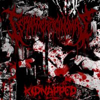 Teratocarcinomas - Kidnapped