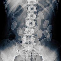 Night Skinny - Mattoni X-Ray