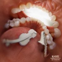 RAYE - Escapism. (Sped Up)