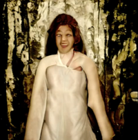 The Carebear - Cerebral Atrophy Part 2