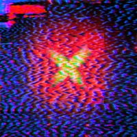 In Explosions - Anaesthesia