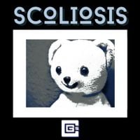 CG5 - Scoliosis