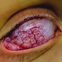 iRis.EXE - chemical bleed (circles in the dark)