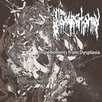 Glossectomy - Impediments From Dysplasia