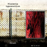 Placenta Lyposuction - Crust